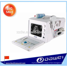 B mode portable ultrasound machines for sale & price ultrasound scanner